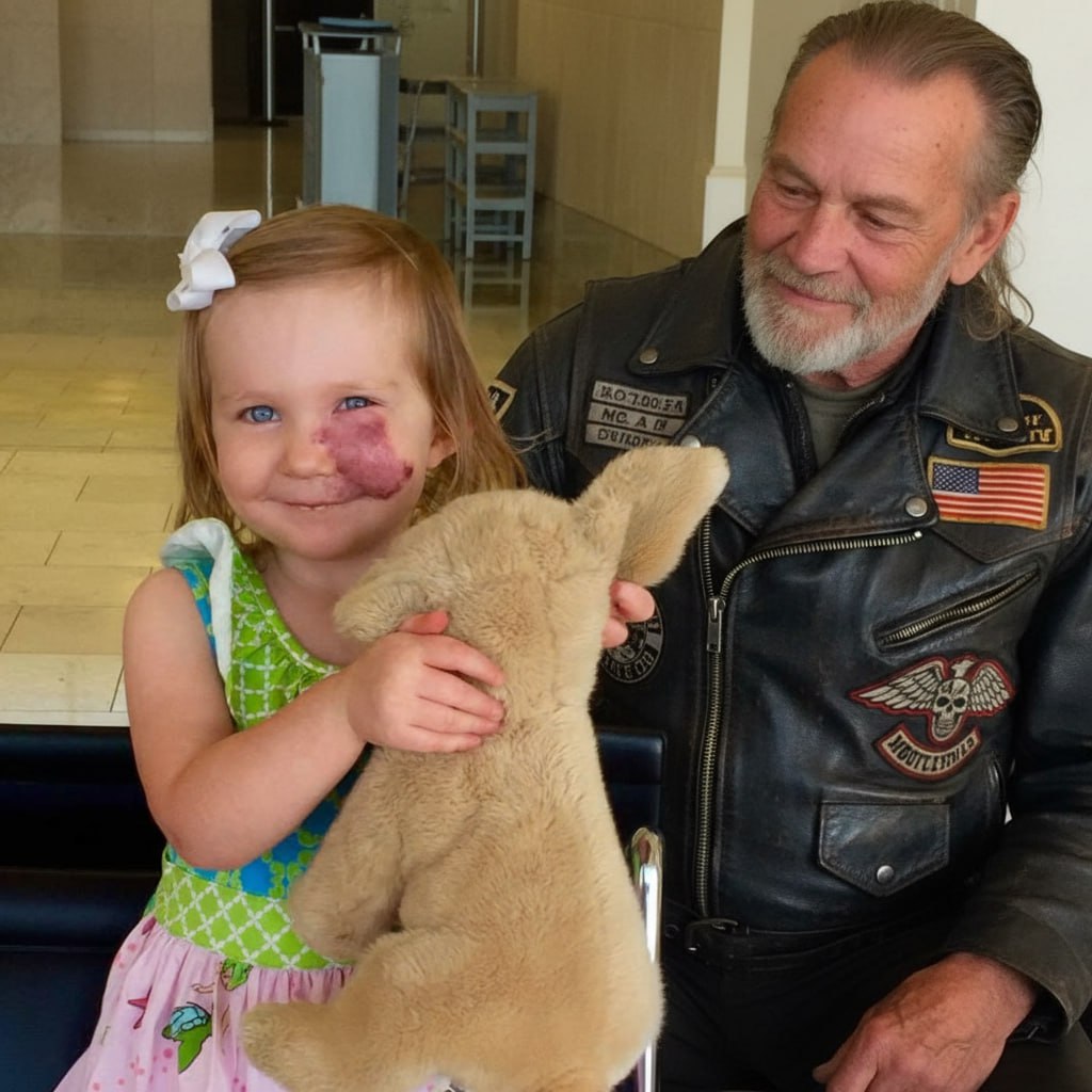 Biker Begged To Adopt The Girl Whom Everyone Rejected Because of Her Face Tumor!
