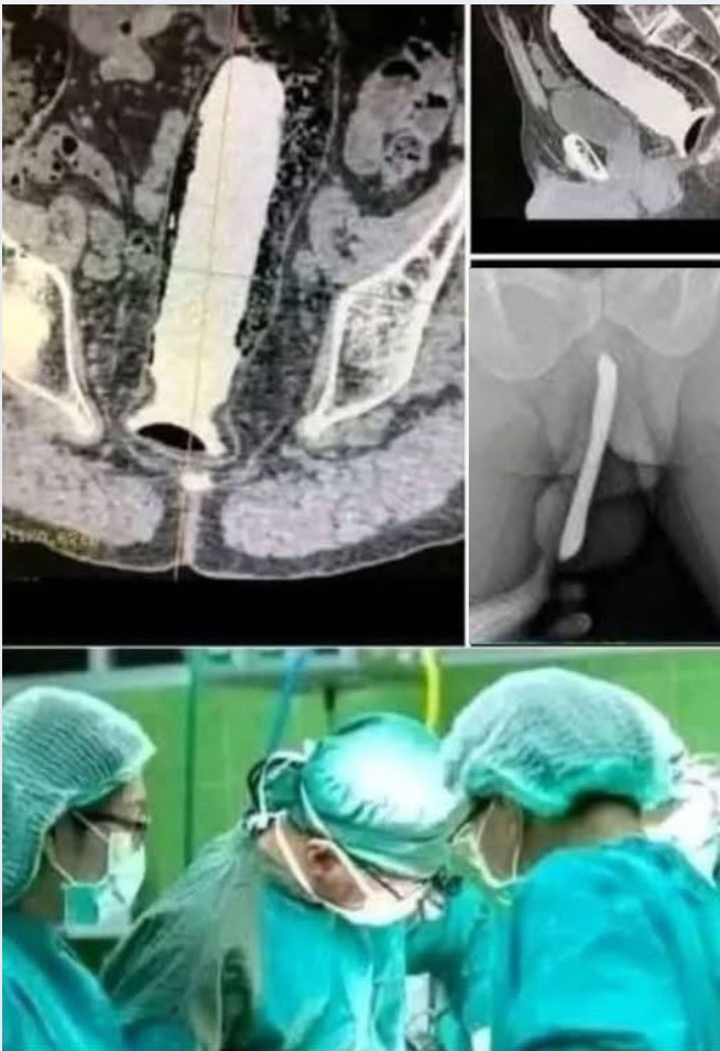 Teen Rushed to Hospital After Dangerous Experiment! A Stark Reminder on Safety