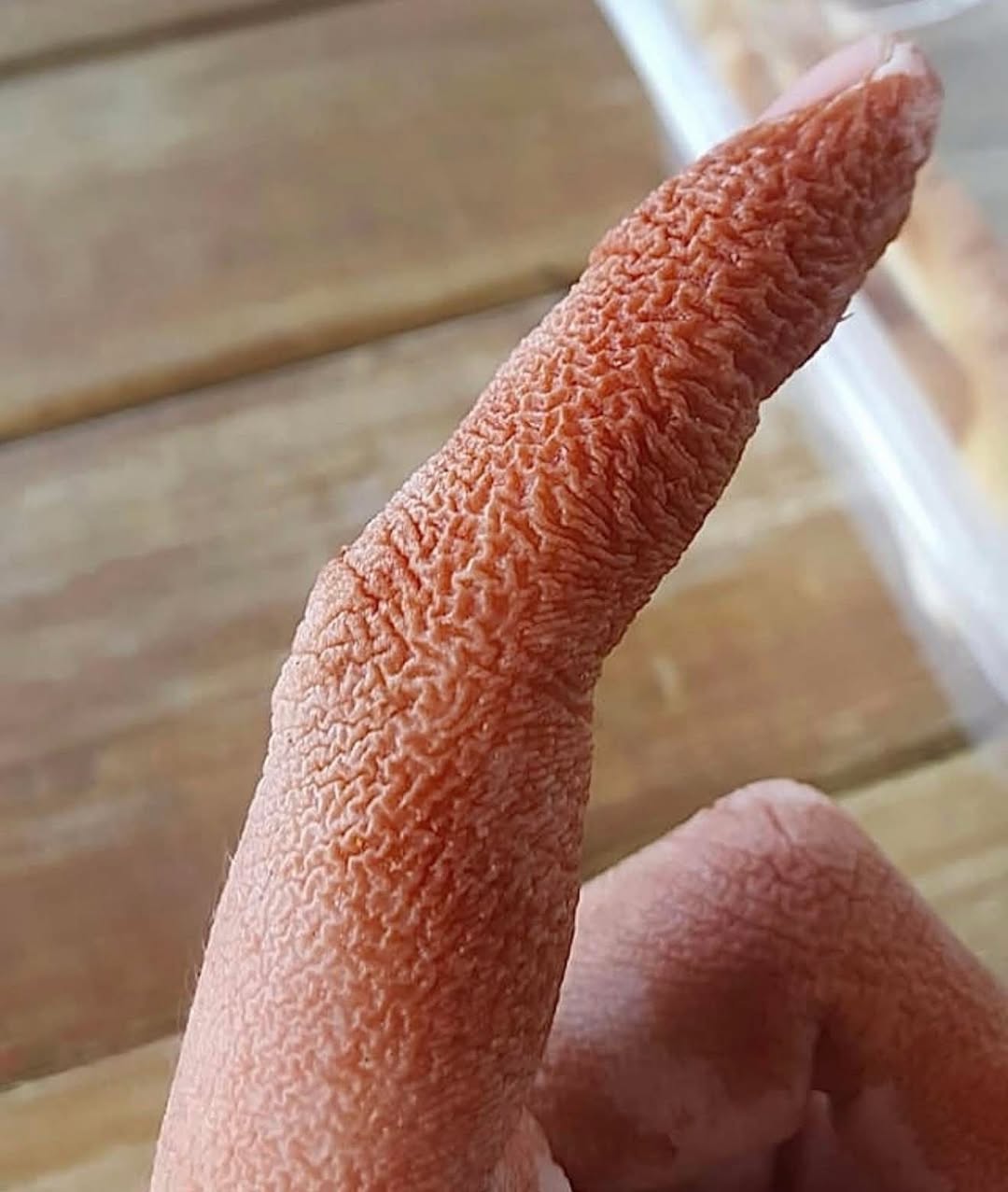 SHOCKING MEDICAL MYSTERY REVEALED AS SUDDEN PAINFUL LESIONS ON WOMANS FACE LEAD TO RARE DIAGNOSIS THAT STUNNED DOCTORS